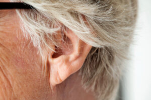 Close up of earlobe with crease