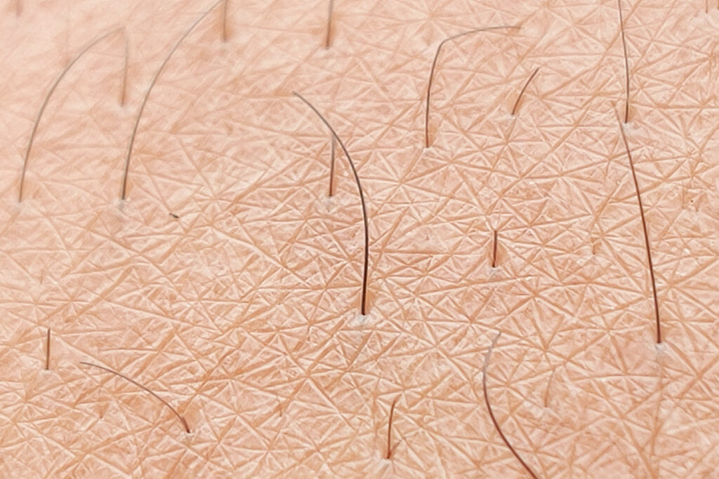 Close up of dark hair on skin